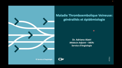 Maladie thromboembolique veineuse (MTEV): généralités et épidémiologie
