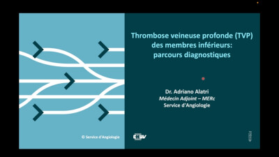 Thrombose veineuse profonde (TVP) des membres inférieurs : parcours diagnostiques