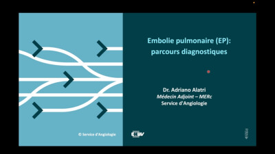 Embolie pulmonaire (EP) : parcours diagnostiques
